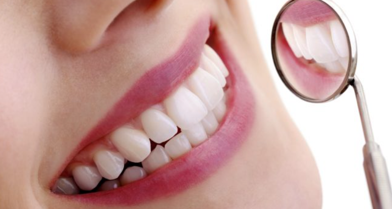 Full mouth dental implants