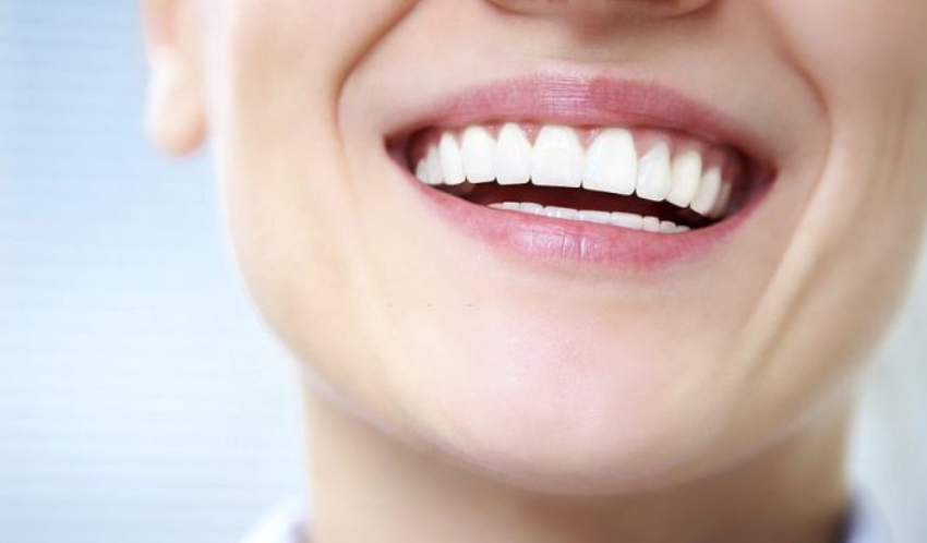 Dental filling services