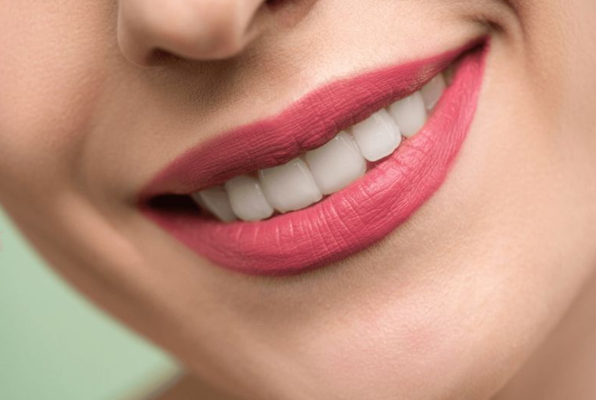 How long does teeth whitening last?