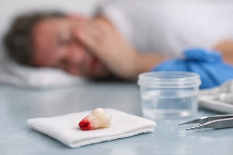 How to Save a Knocked Out Tooth After an Accident