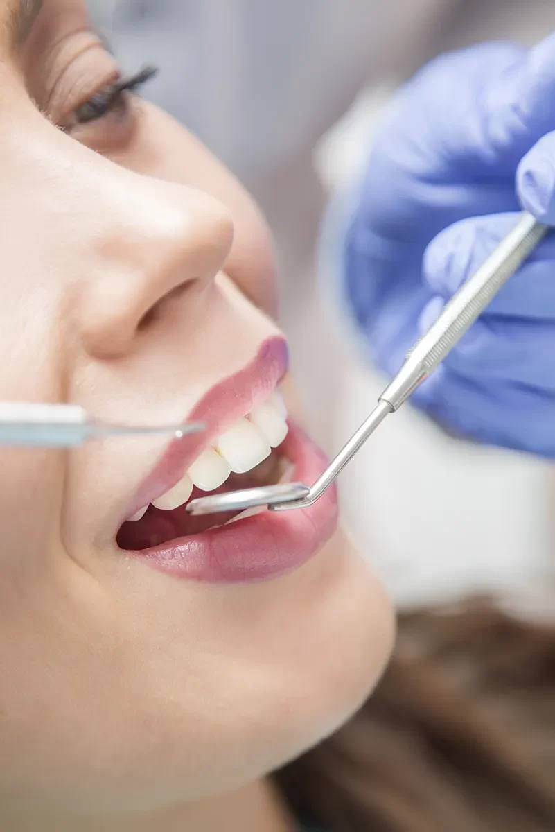 Dental Bridges