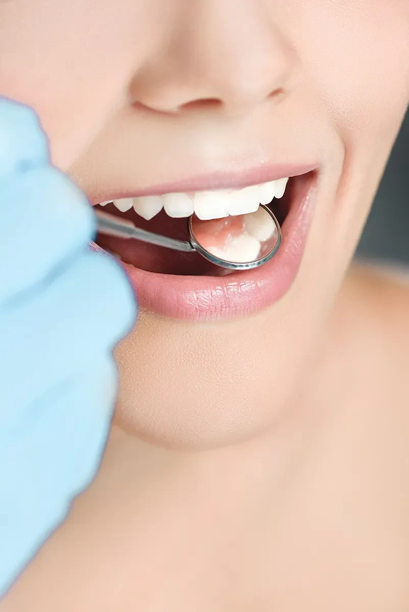 Dental Crowns