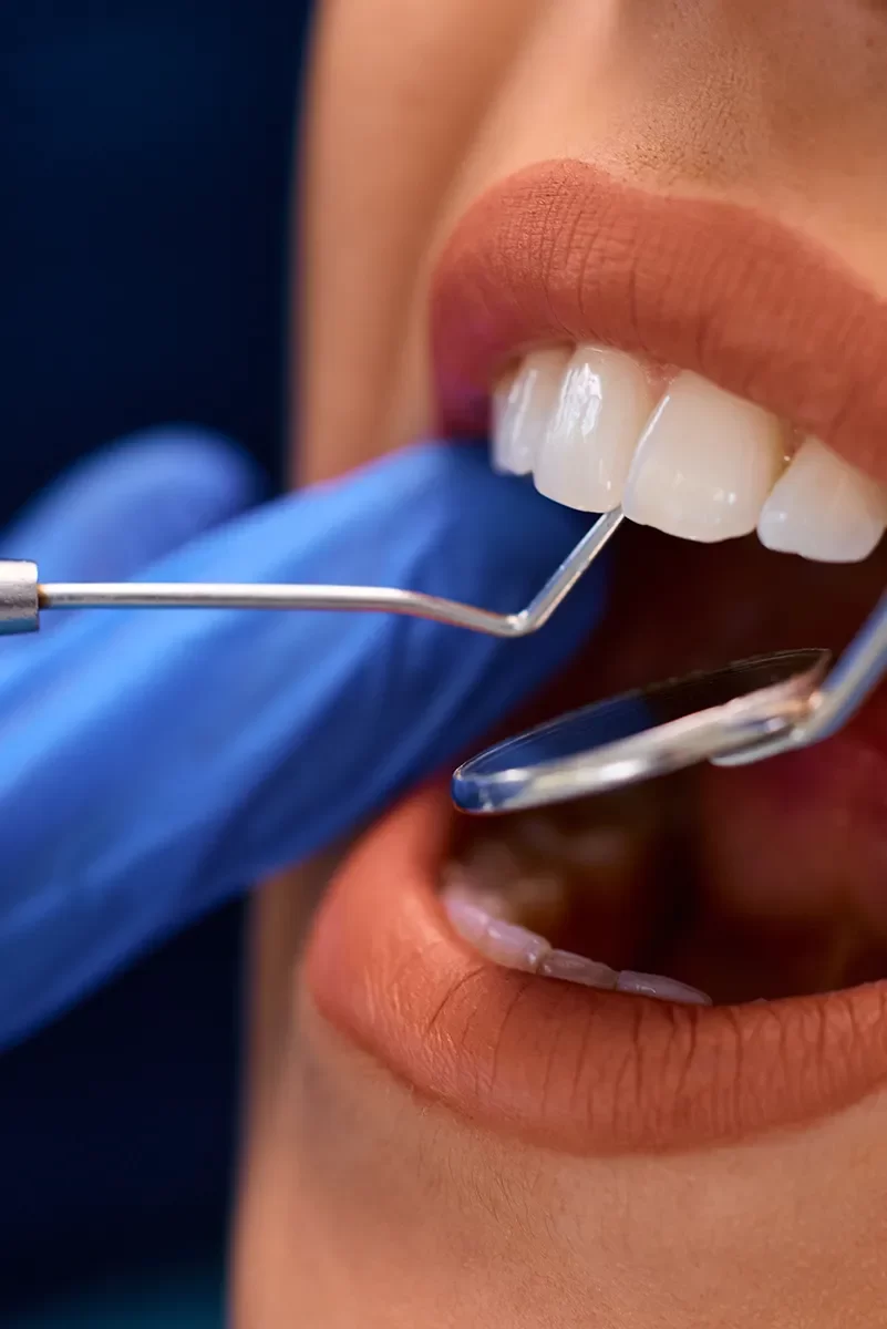Dental Crowns