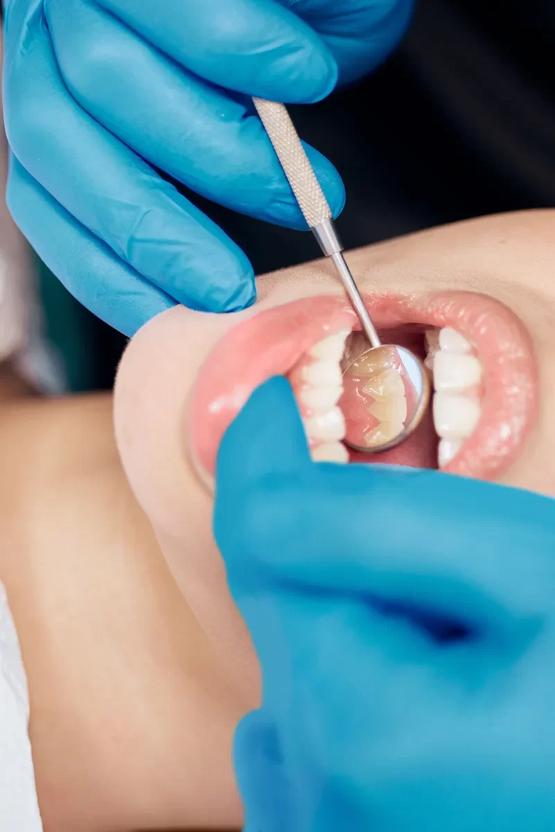 Dental Exams