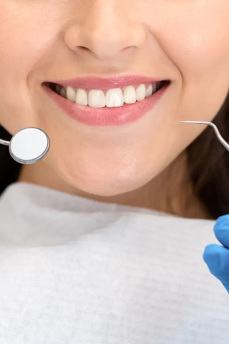 Dental Sealants