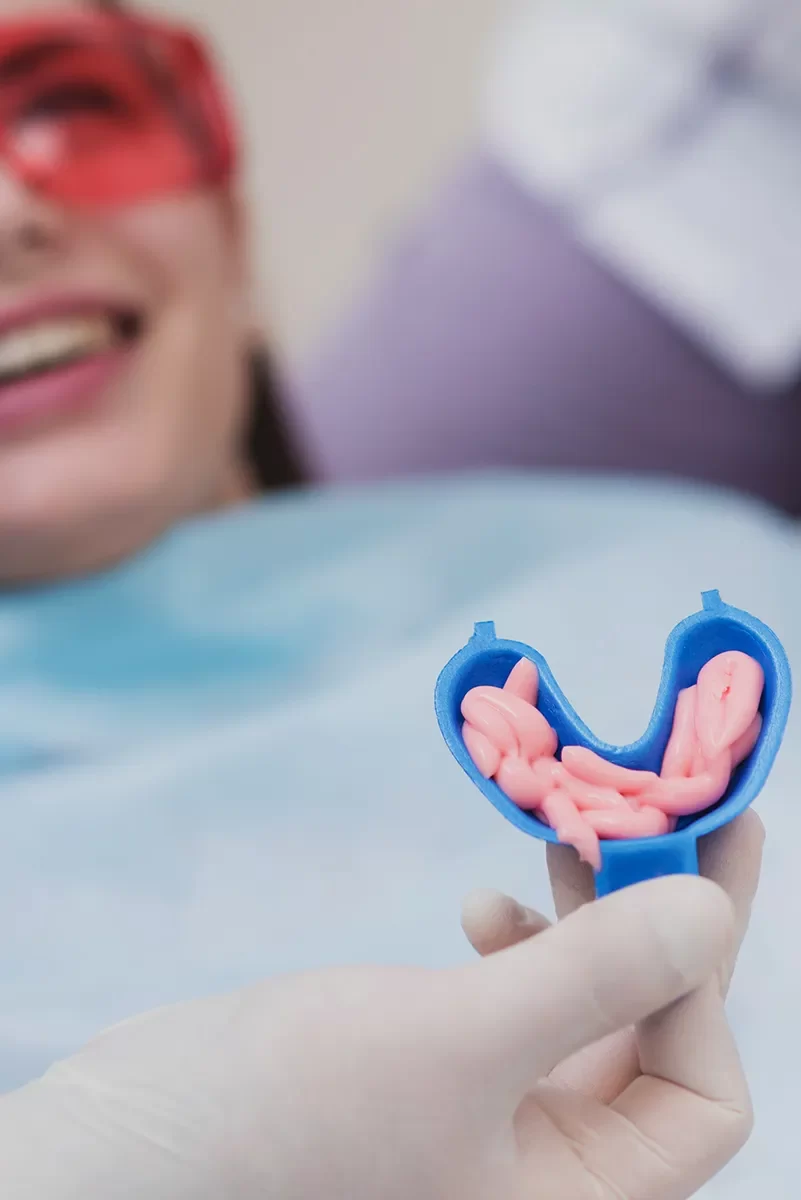 Fluoride Treatments