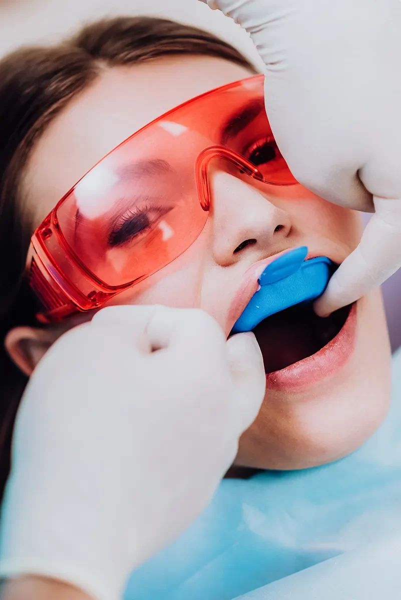 Fluoride Treatments