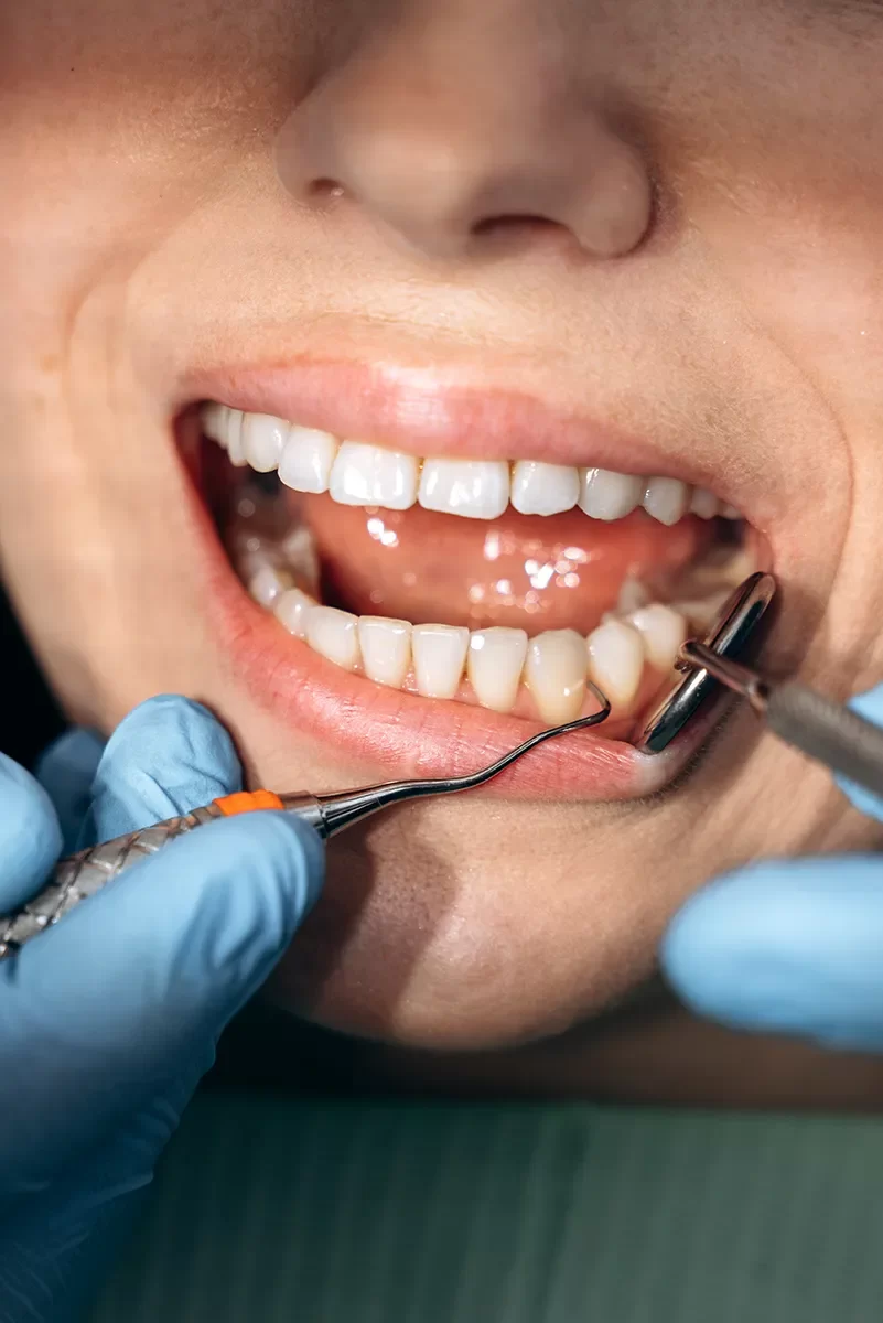 Gum Disease Therapy