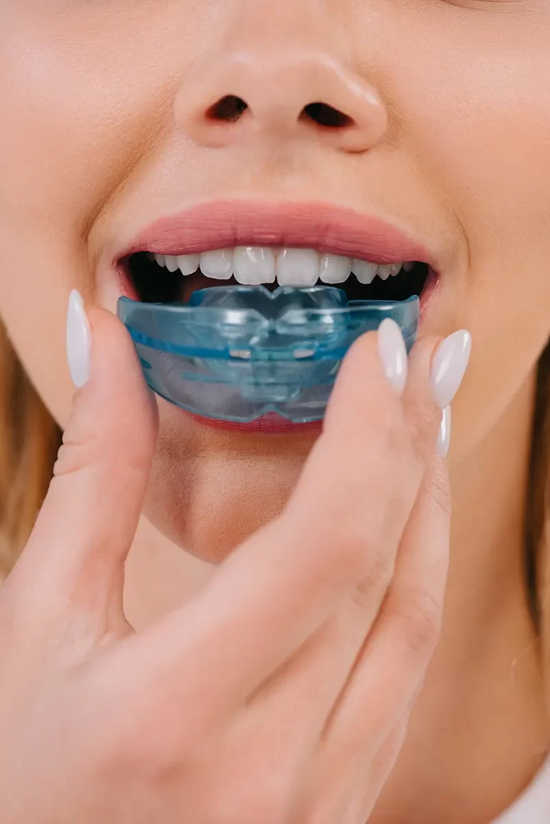 Night Guards for Teeth Grinding (Bruxism)