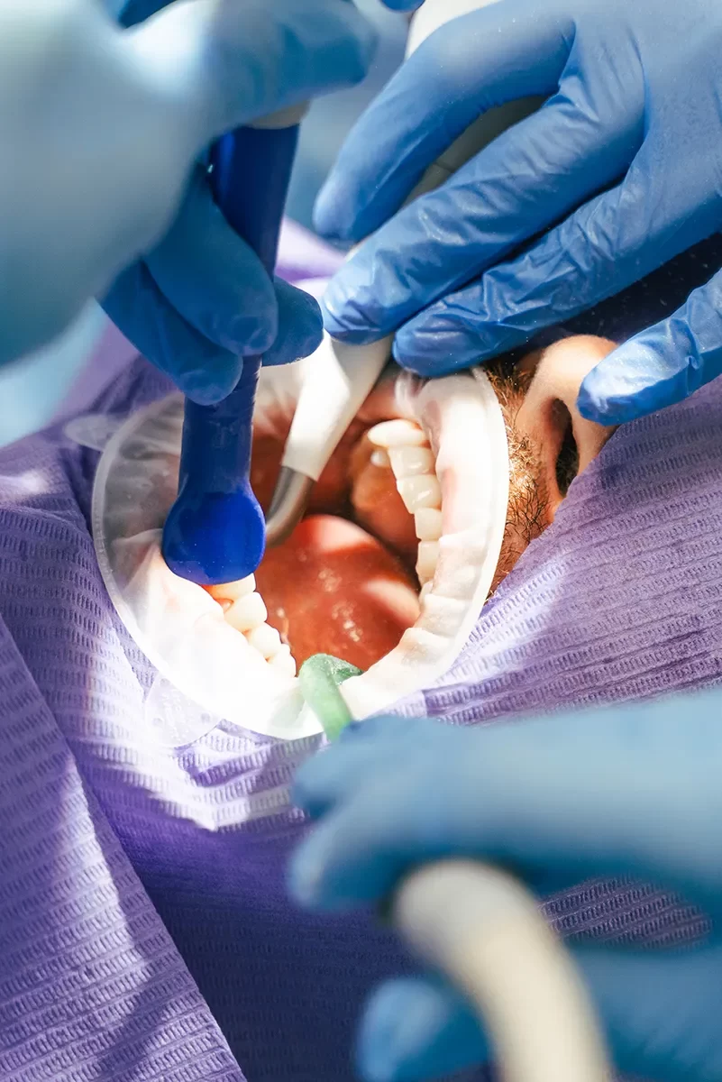 Oral Surgery