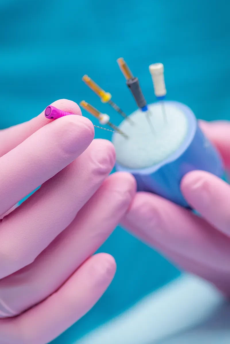 Root Canal Therapy