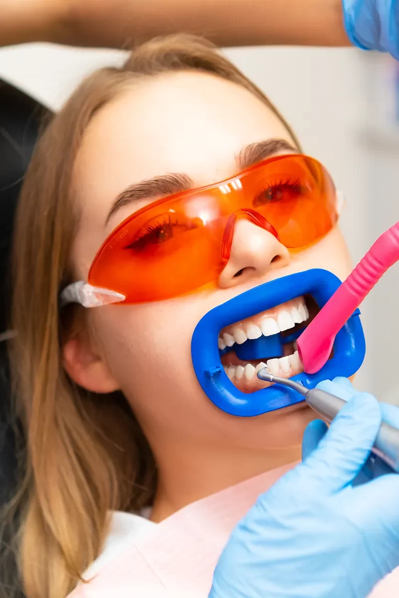 Teeth Whitening
