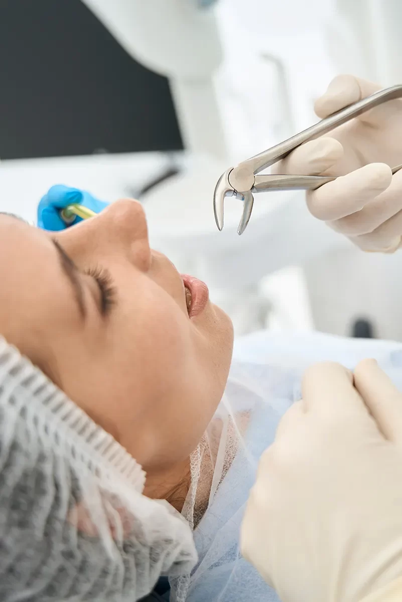 Wisdom Teeth Removal